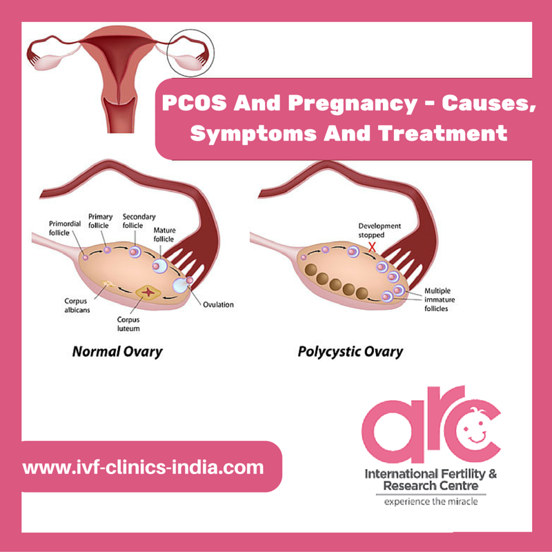 Arc International Fertility & Research Centre Image 11