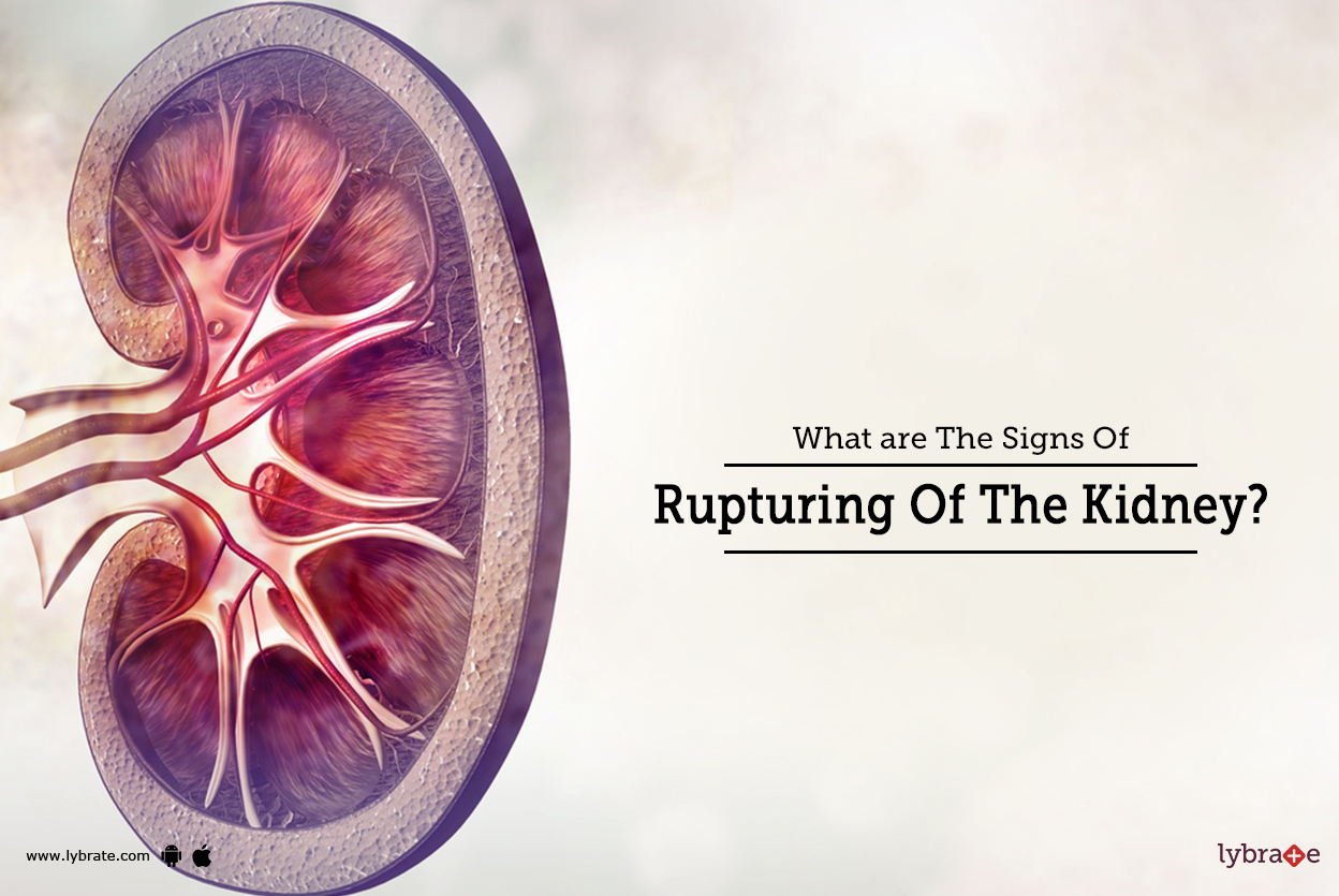 What are The Signs Of Rupturing Of The Kidney? By Dr. Garima Lybrate