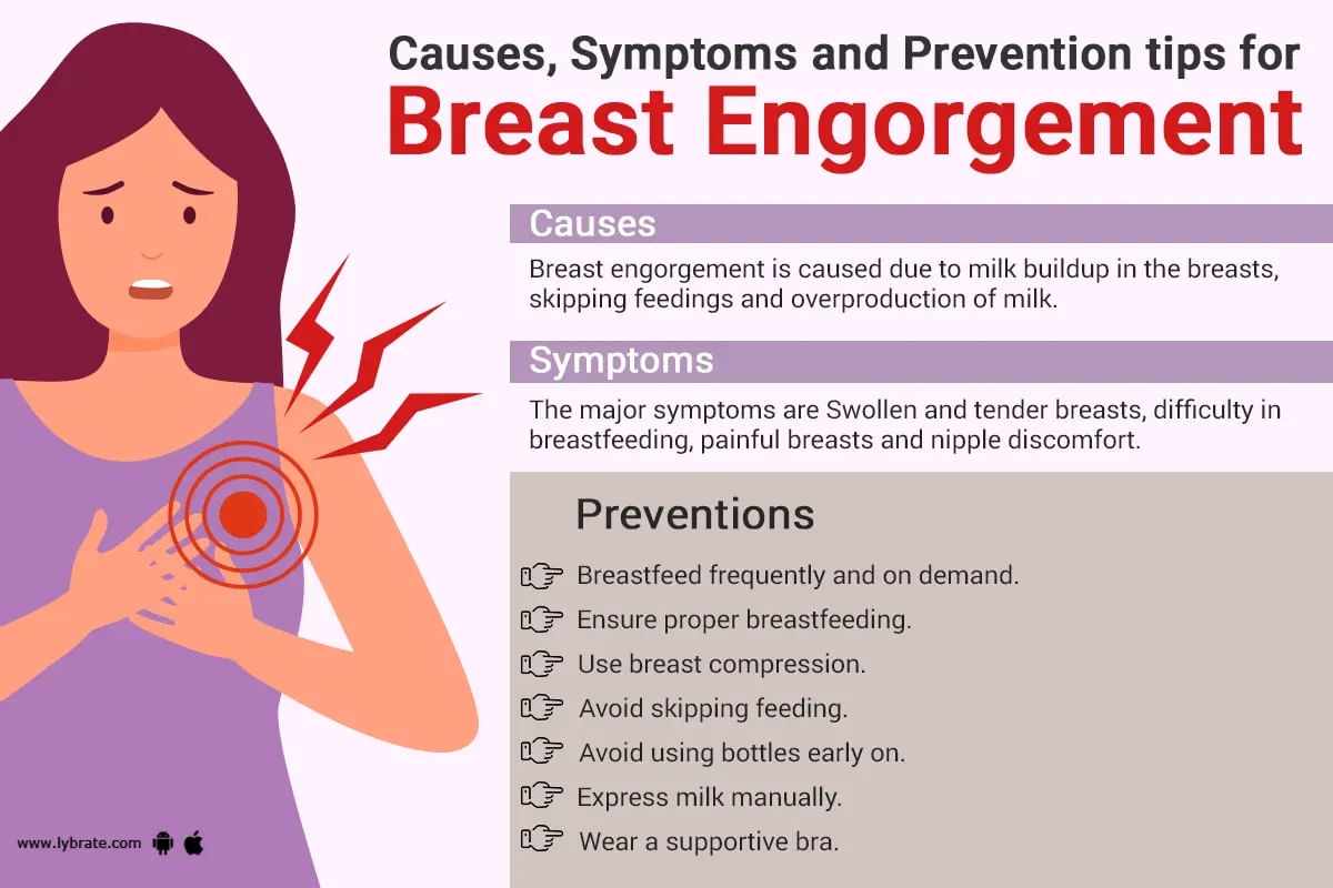 Breast Engorgement While Pregnant and Breastfeeding