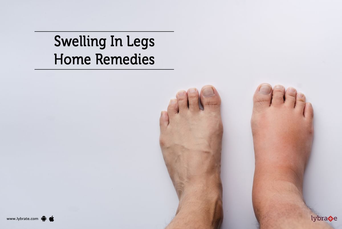 swelling-in-legs-home-remedies-by-dr-nandeesh-j-lybrate