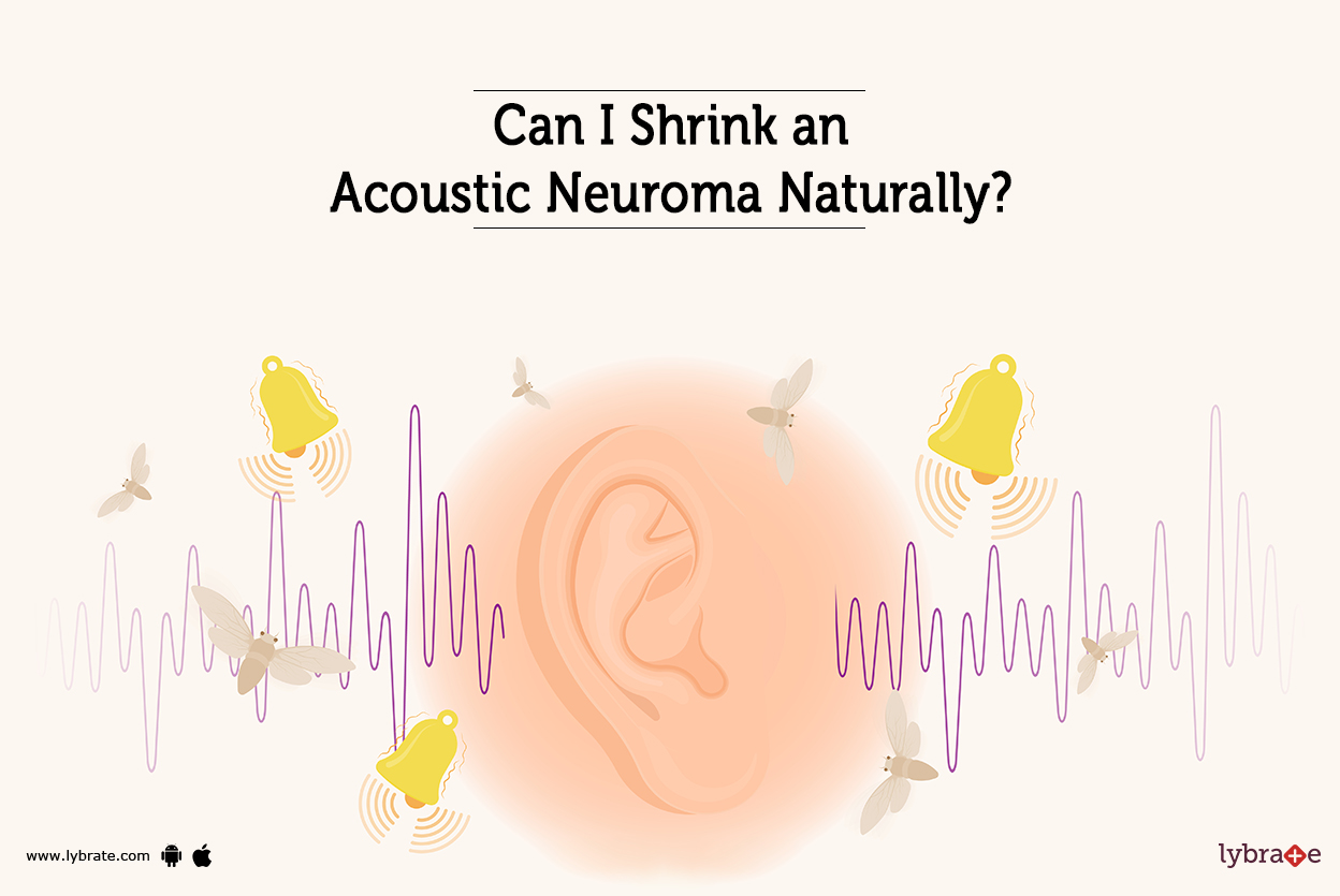 Can I Shrink an Acoustic Neuroma Naturally? By Dr. Nagaraj Poojary Can I Shrink an Acoustic Neuroma Naturally? By Dr. Nagaraj Poojary