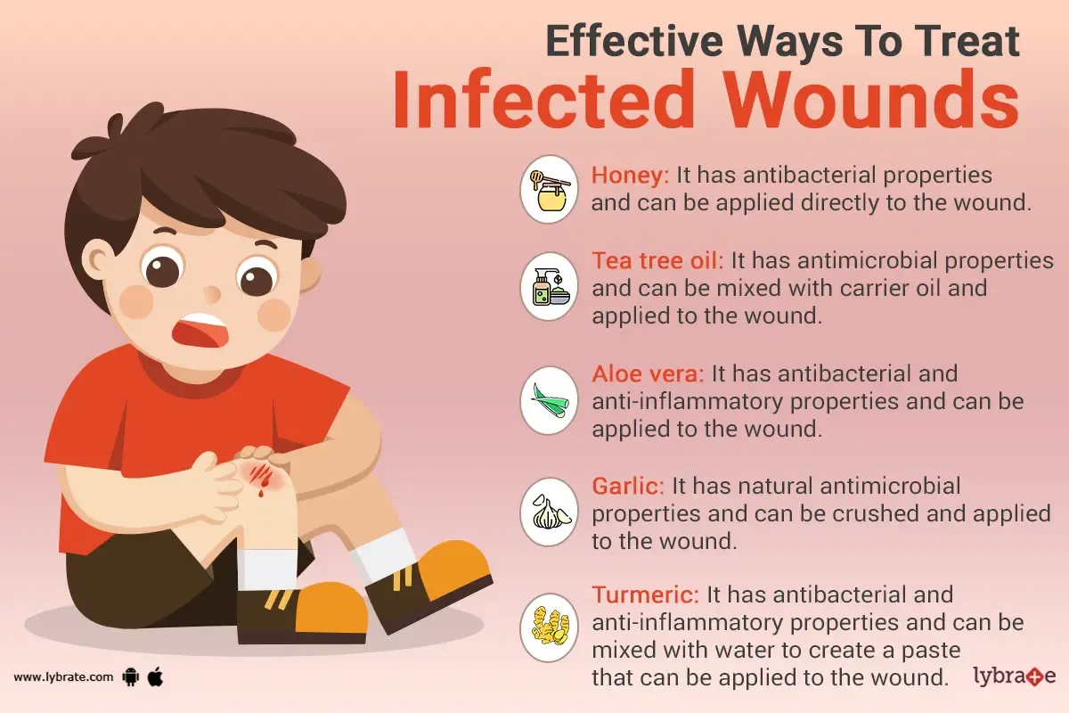 Ways To Treat An Infected Wound Naturally By Dr Mitalee Gupta Lybrate