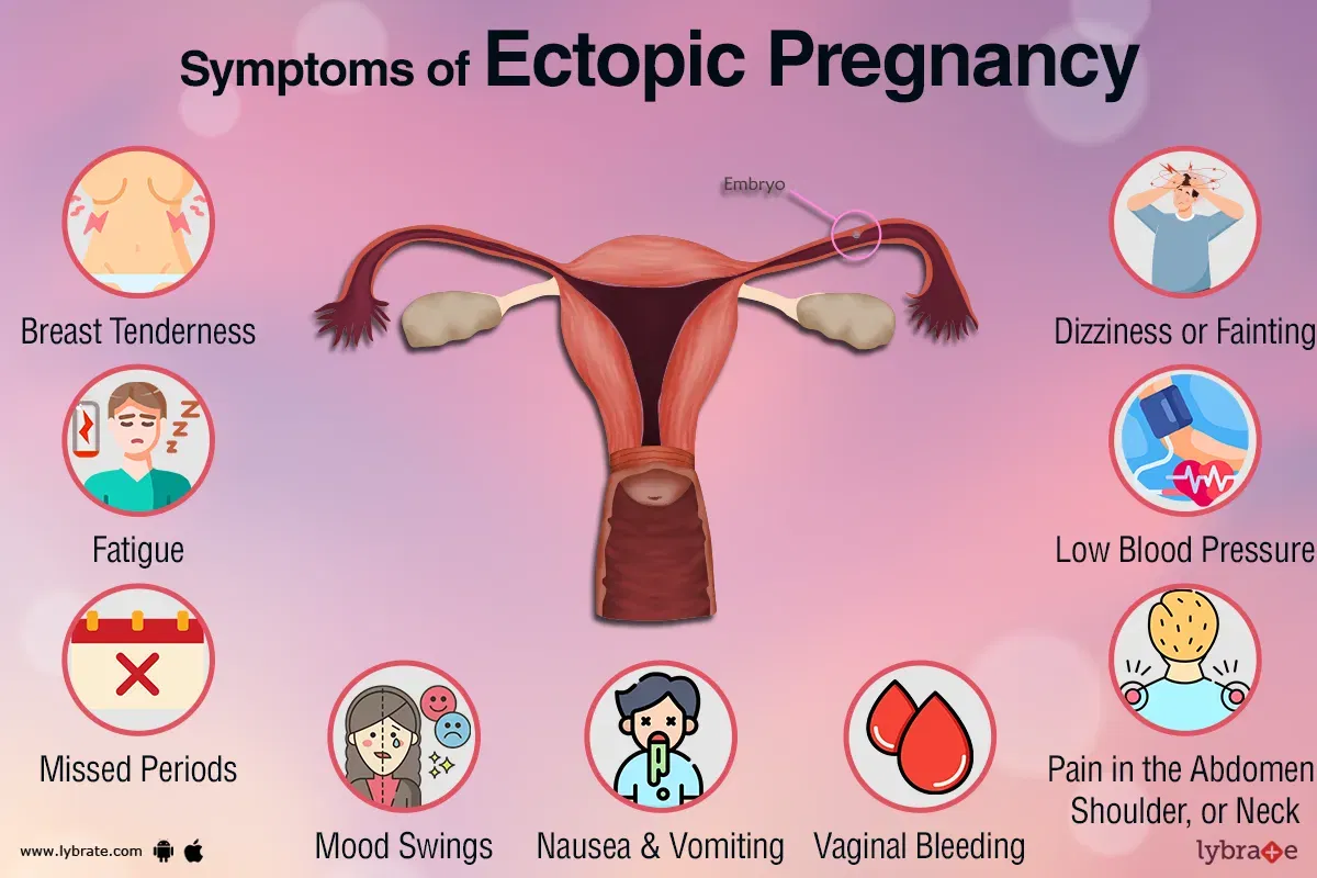 Blood Pressure In Ectopic Pregnancy