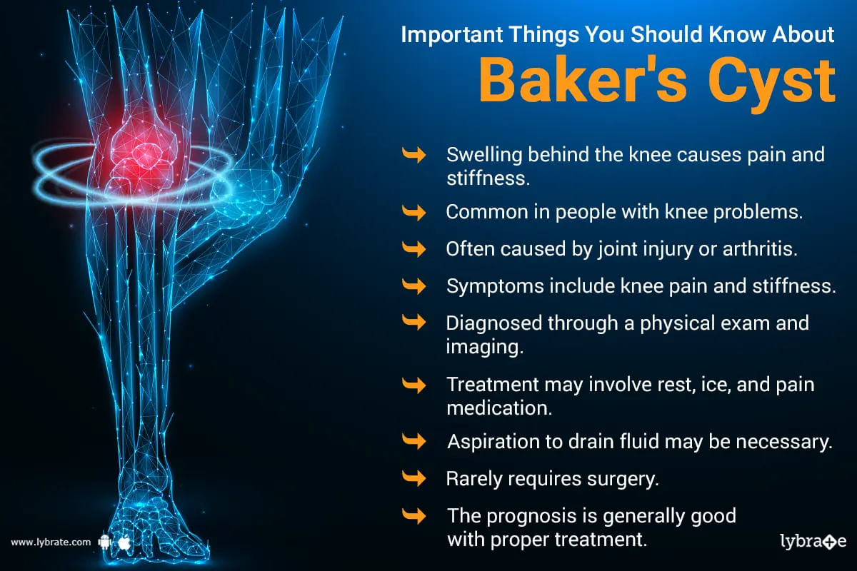Baker Cysts Symptoms Causes And Treatment Options By Dr Mohit Madan Lybrate