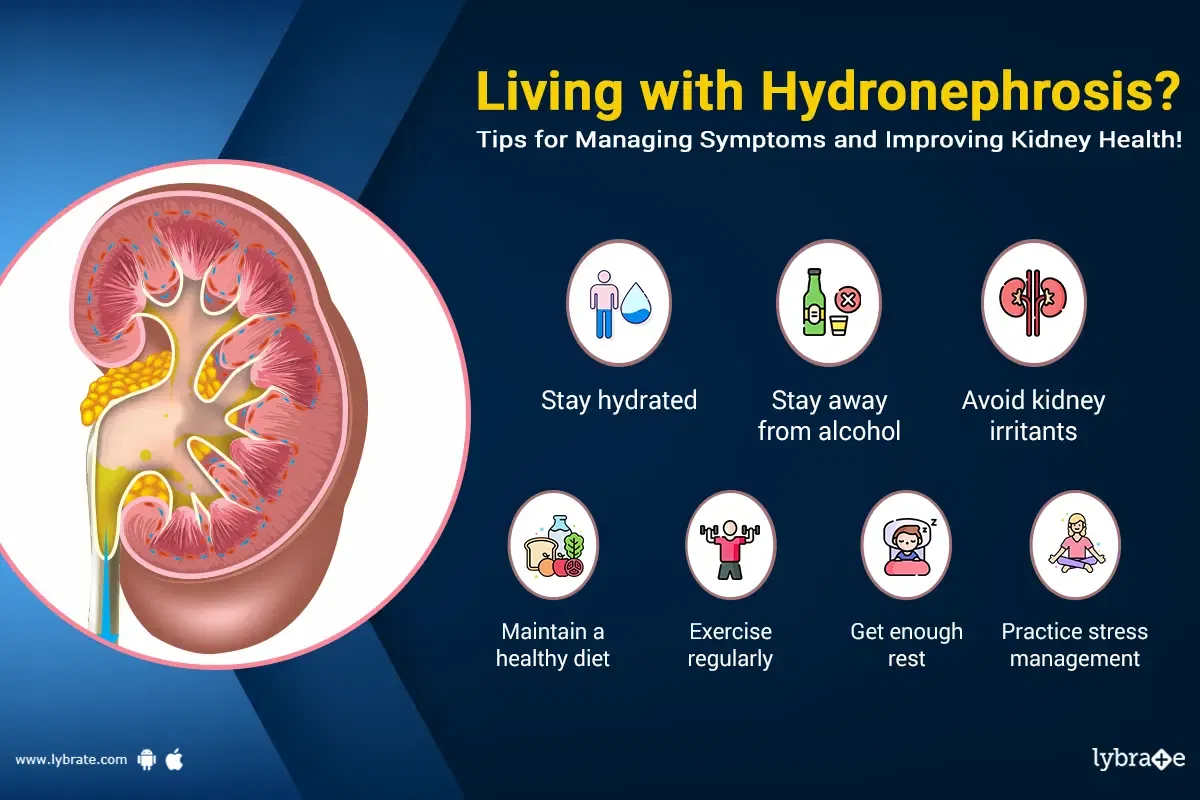 hydronephrosis case study scribd