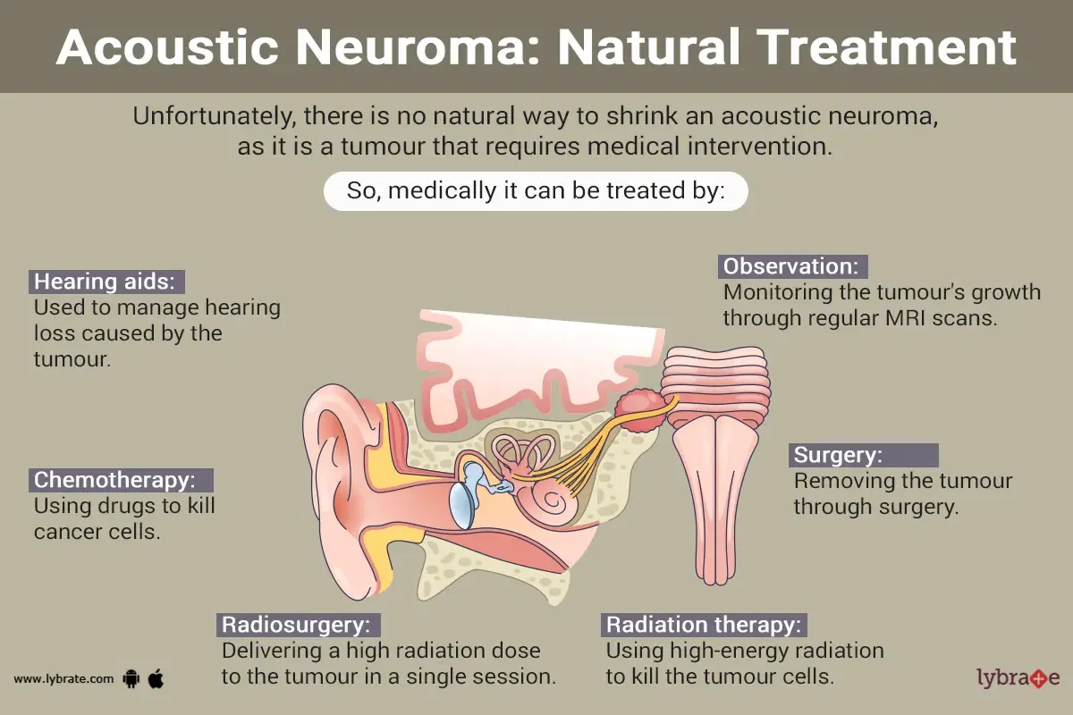 can-i-shrink-an-acoustic-neuroma-naturally-by-dr-nagaraj-poojary