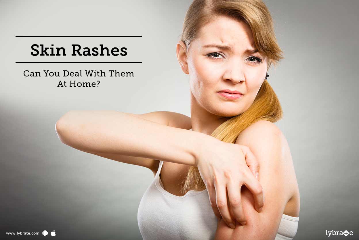Skin Rashes Can You Deal With Them At Home? By Dr. Nitin Jain Lybrate