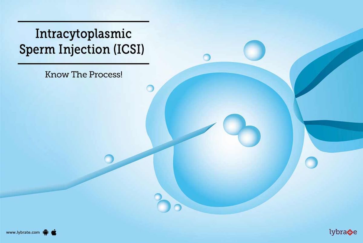 Intracytoplasmic Sperm Injection (ICSI) - Know The Process! - By Dr ...