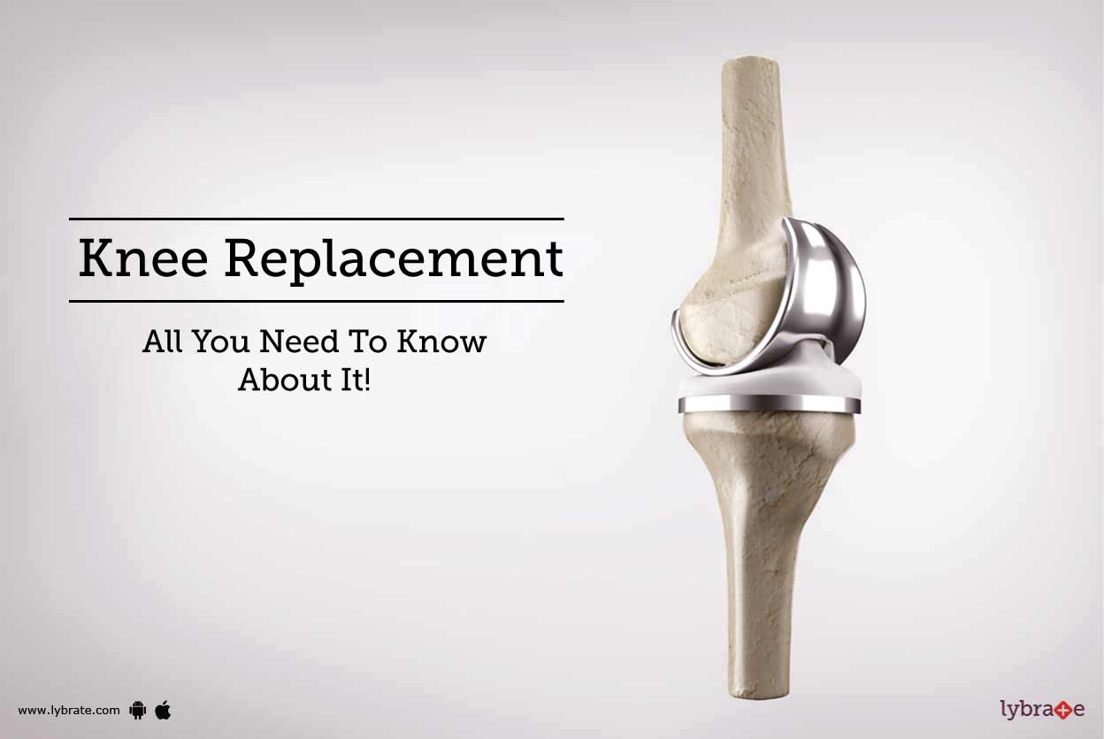 Knee Replacement All You Need To Know About It! By Dr. Vipin Tyagi