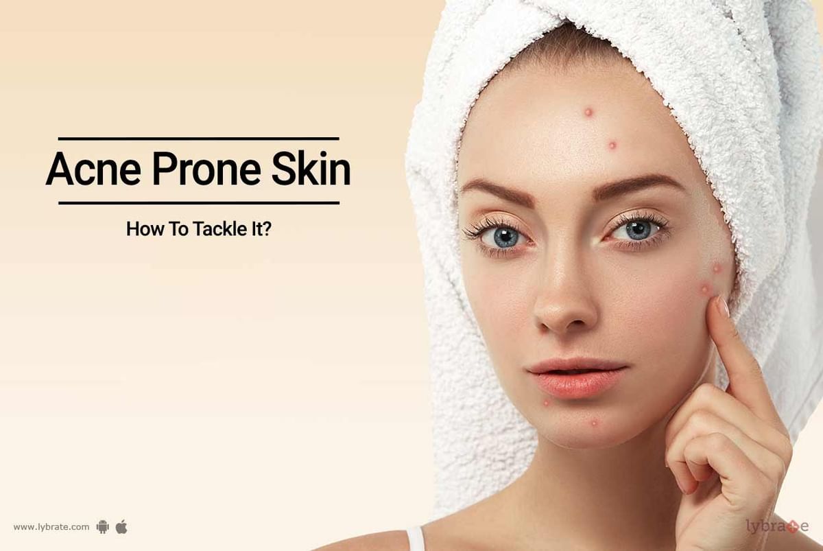 Acne Prone Skin - How To Tackle It? - By Dr. Malini Patil | Lybrate