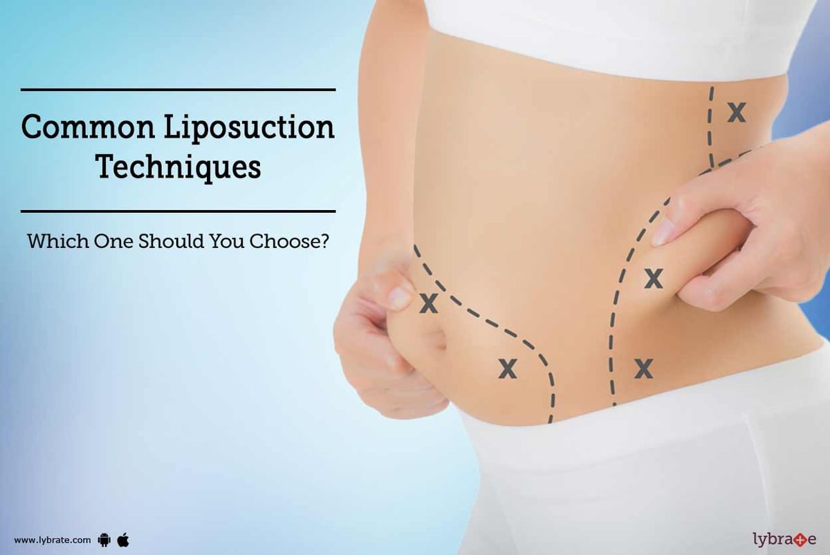 Common Liposuction Techniques - Which One Should You Choose? - By