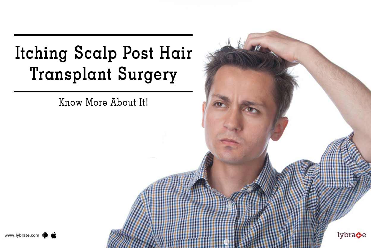Itching Scalp Post Hair Transplant Surgery Know More About It! By