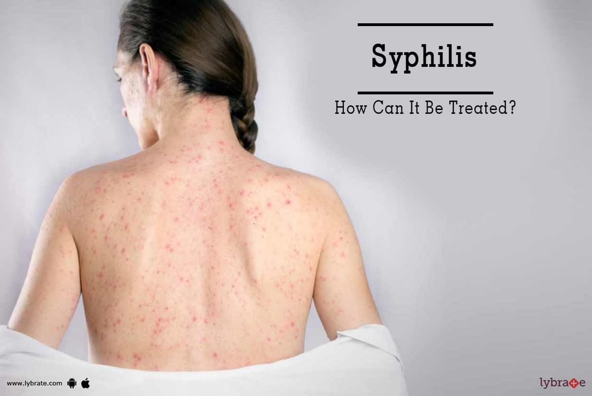 Syphilis How Can It Be Treated By Burlington Clinic India Best Sexologist Lybrate