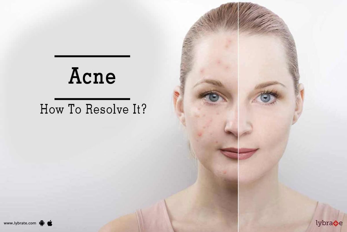 Acne - How To Resolve It? - By Dr. Vijay Khandelwal | Lybrate