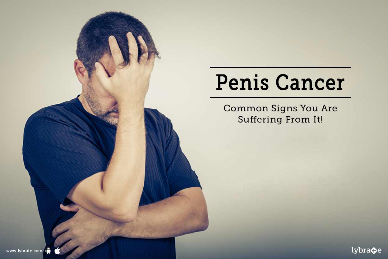 Penis Cancer Common Signs You Are Suffering From It! By Hakim Hari