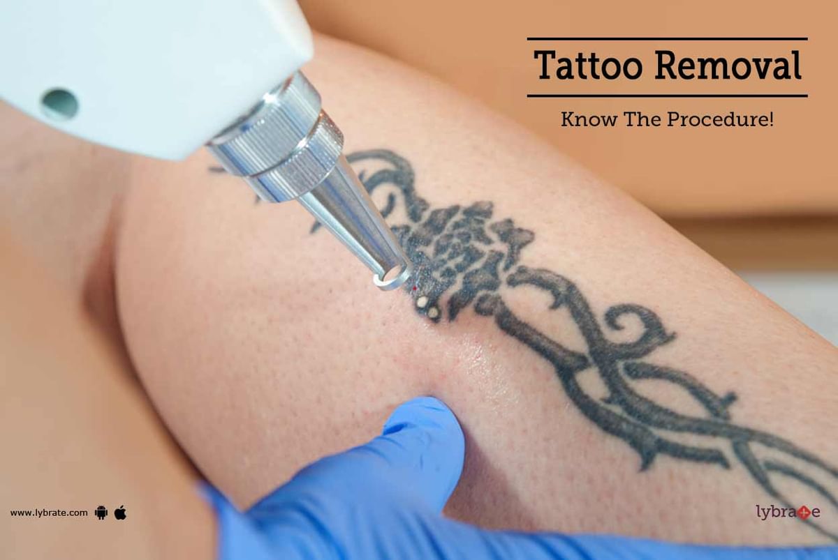 Laser Tattoo Removal | Dezire Clinic Pune, Book an Appointment