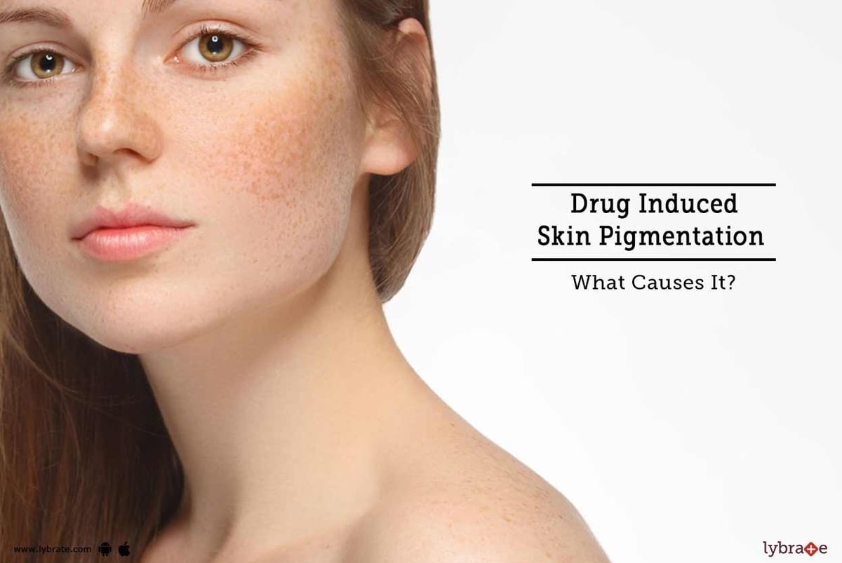 Drug Induced Skin Pigmentation What Causes It By Isaac