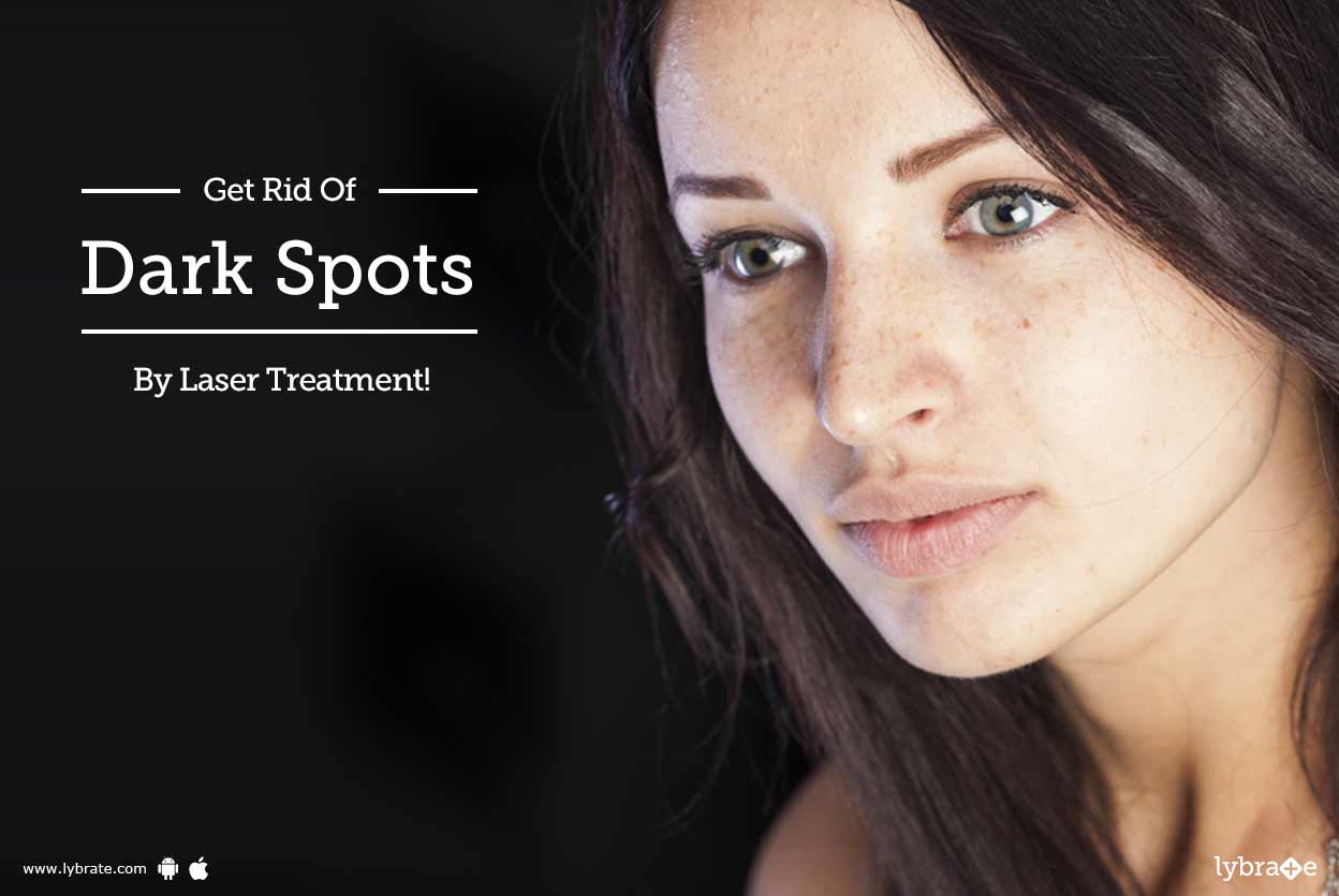 Get Rid Of Dark Spots By Laser Treatment! By Dr. Sandesh Gupta Lybrate