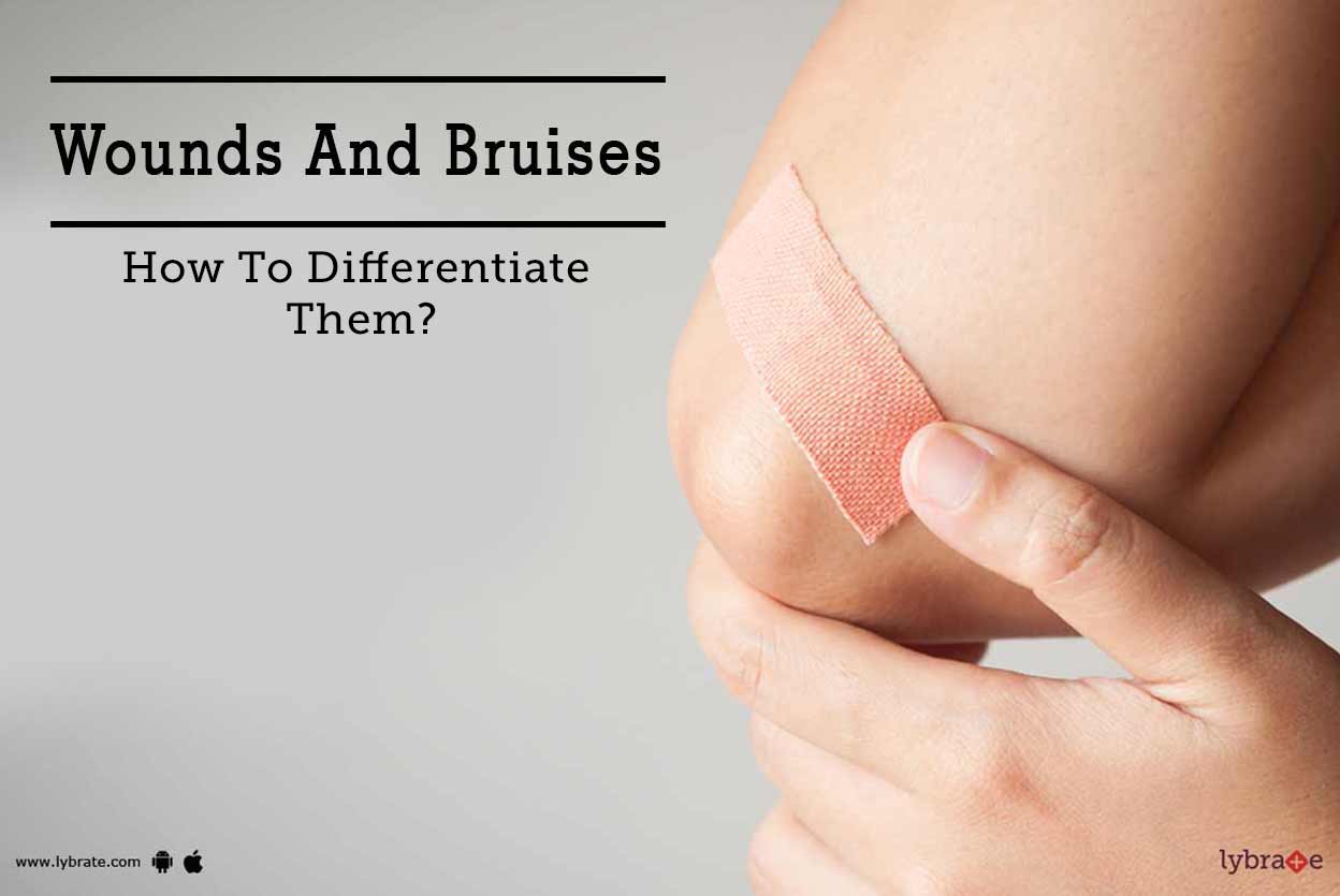 Wounds And Bruises How To Differentiate Them? By Dr. Tarun Jhamb