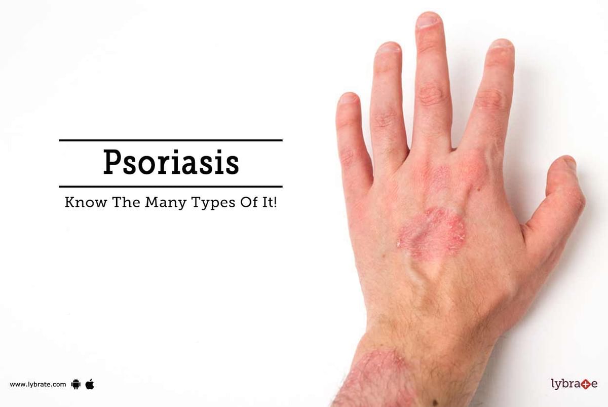 Psoriasis - Know The Many Types Of It! - By Dr. G L Prasad | Lybrate