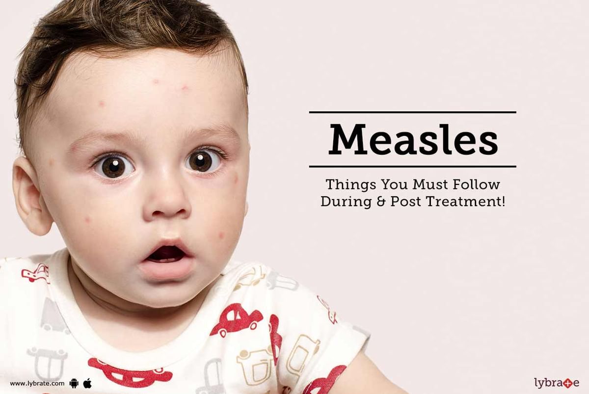 Measles - Things You Must Follow During & Post Treatment! - By Dr ...