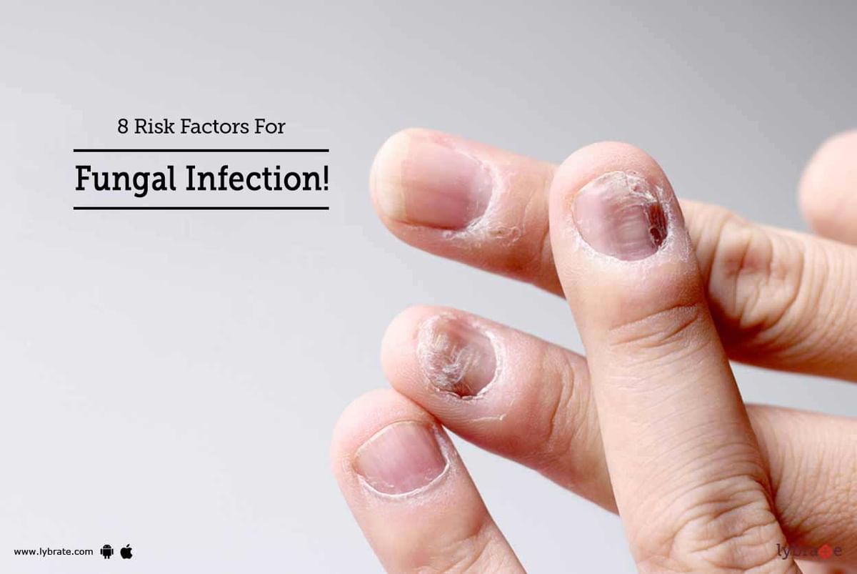 8 Risk Factors For Fungal Infection By Dr Hetal Jobanputra Lybrate
