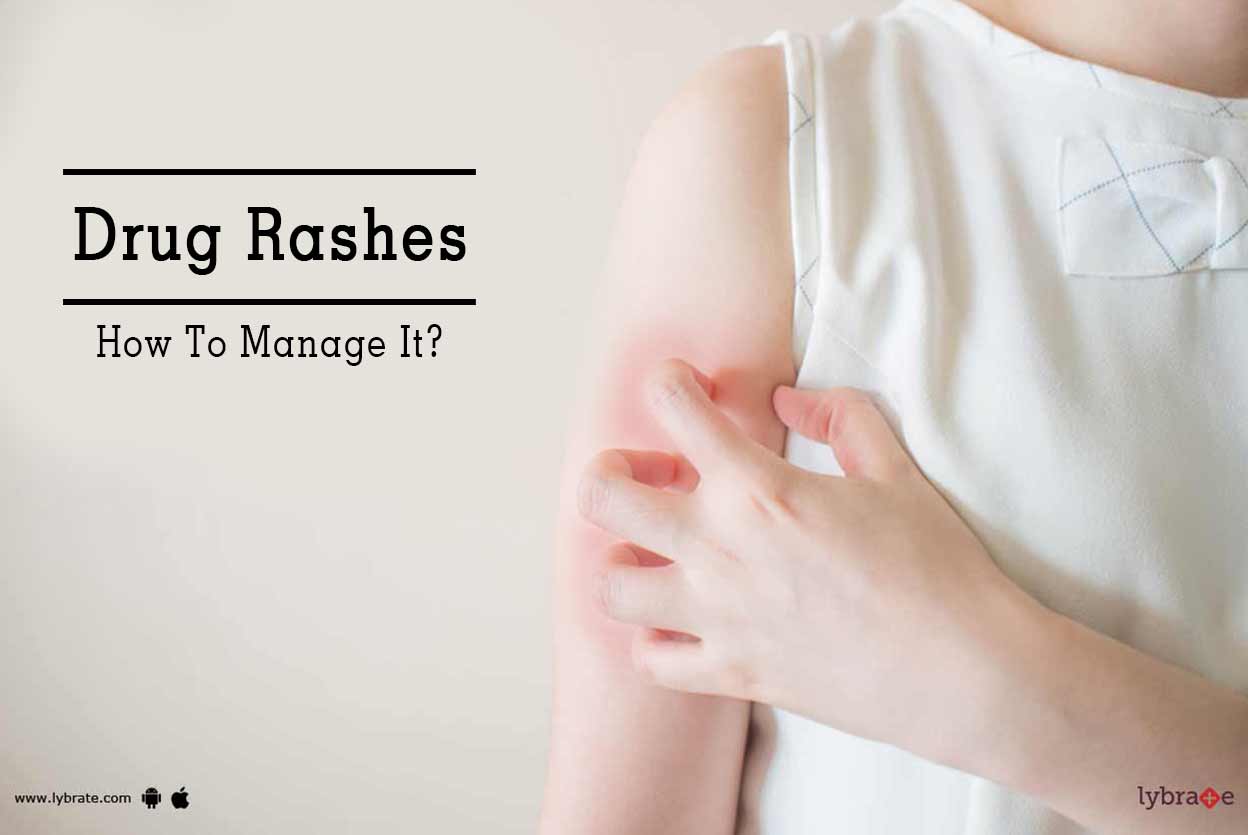 Drug Rashes How To Manage It? By Dr. Ankush Gupta Lybrate