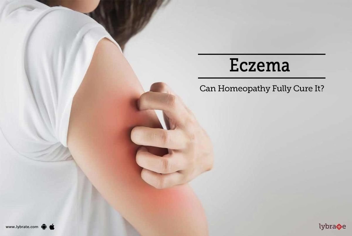 Eczema - Can Homeopathy Fully Cure It? - By Dr. Vishal Shah | Lybrate