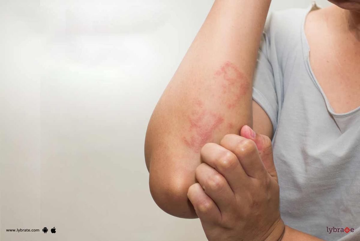 Keratosis Pilaris Causes Management And Treatment By Derma Circles Doctors From Aiims