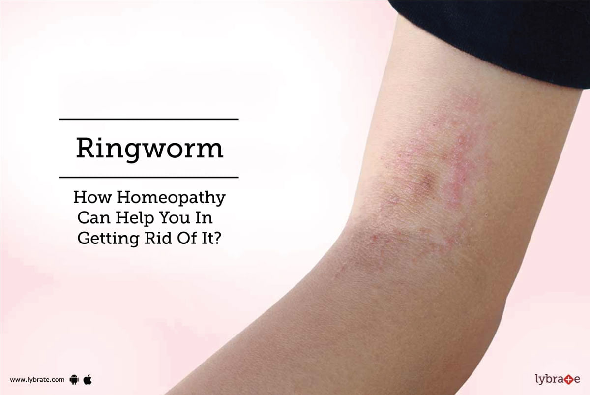 Ringworm - How Homeopathy Can Help You In Getting Rid Of It? - By Dr ...