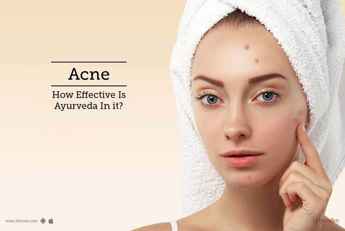 Acne - How Effective Is Ayurveda In It? - By Dr. Rituraj Taank | Lybrate