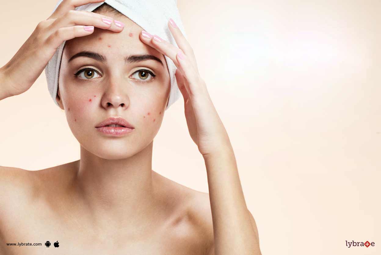 Are Acne And Pimples The Same Thing? By Dr. Mudasir Rashid Khan Lybrate