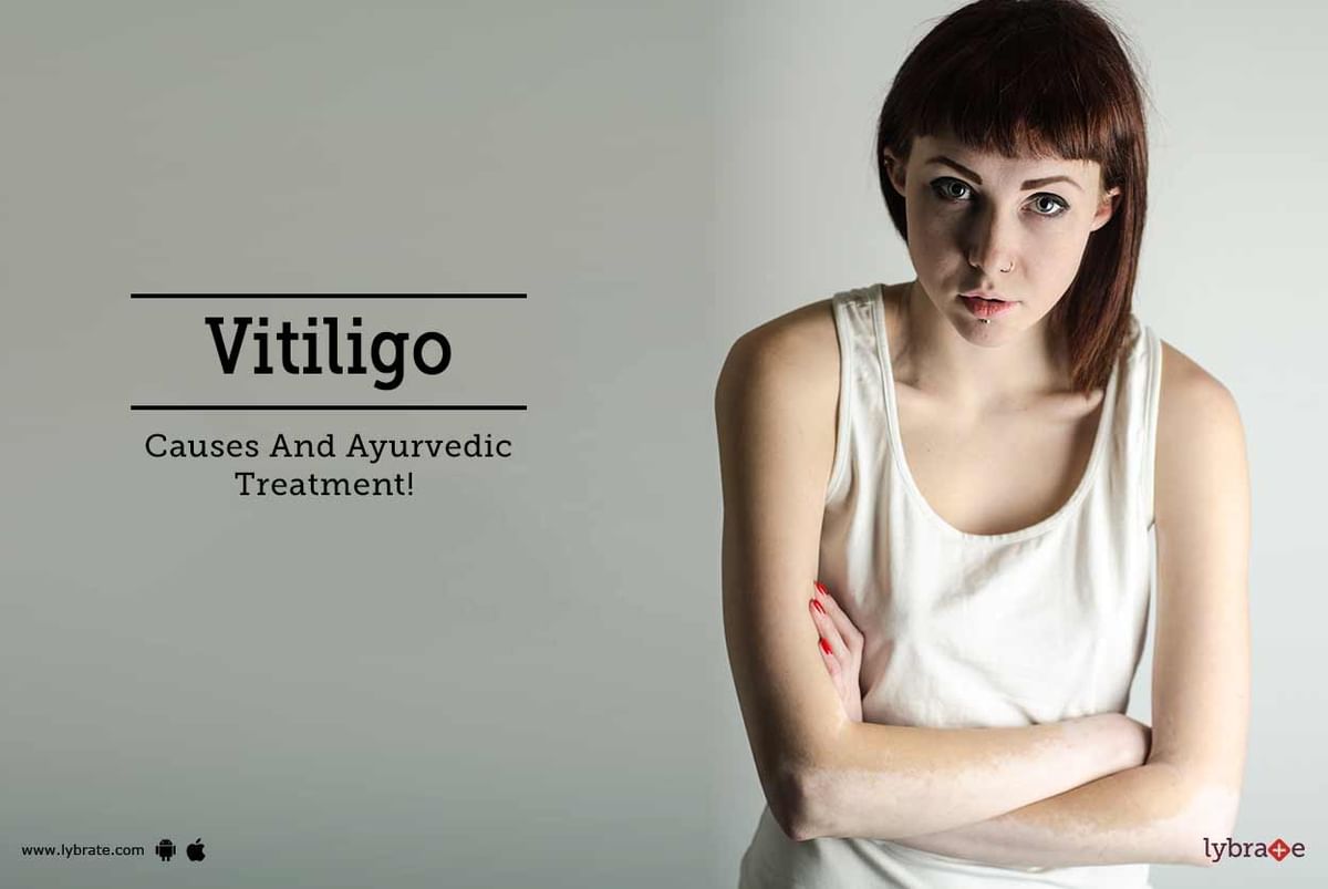 Vitiligo - Causes And Ayurvedic Treatment! - By Dr. Jyotsna Makkar ...