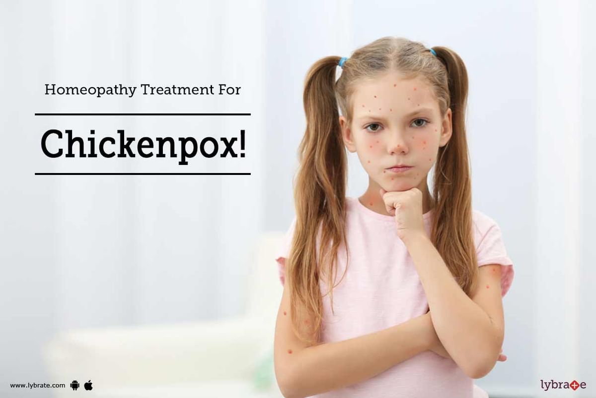 Homeopathy Remedies For Chickenpox - Natural Treatment - By Dr ...