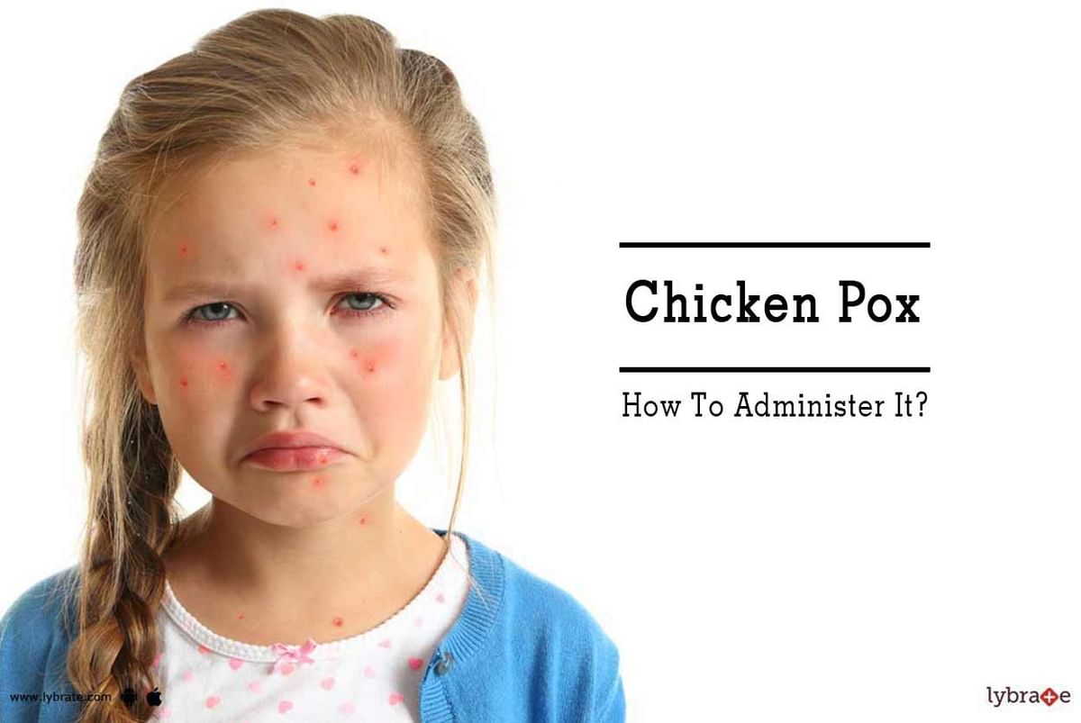 Chicken Pox - How To Administer It? - By Dr. Jyoti Gulati | Lybrate