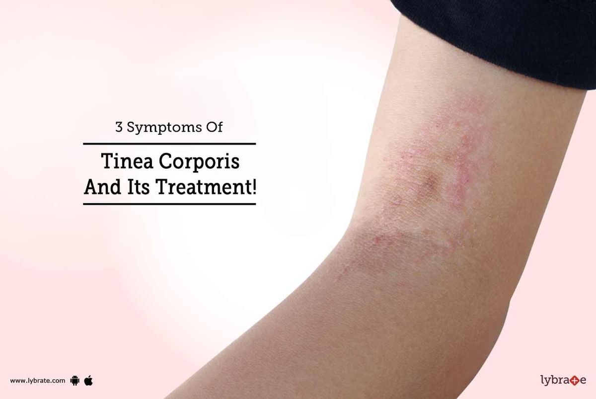 Tinea corporis infection  Ring worm symptoms, treatment and causes 