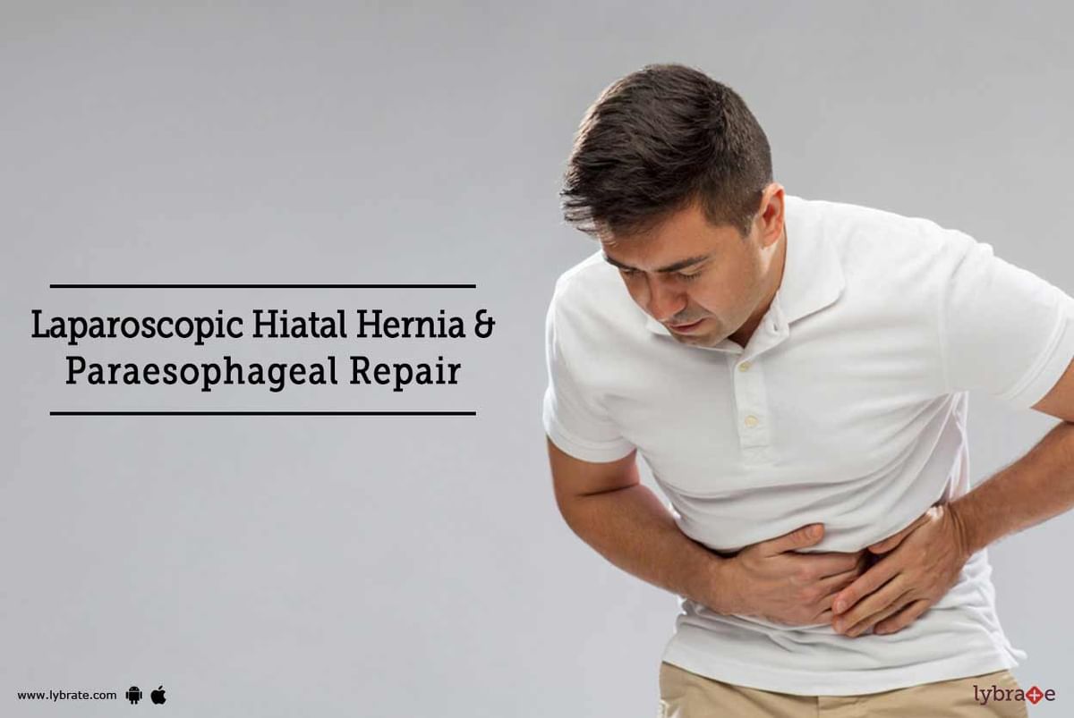 Laparoscopic Hiatal Hernia & Paraesophageal Repair - By Dr. G M Irfan ...