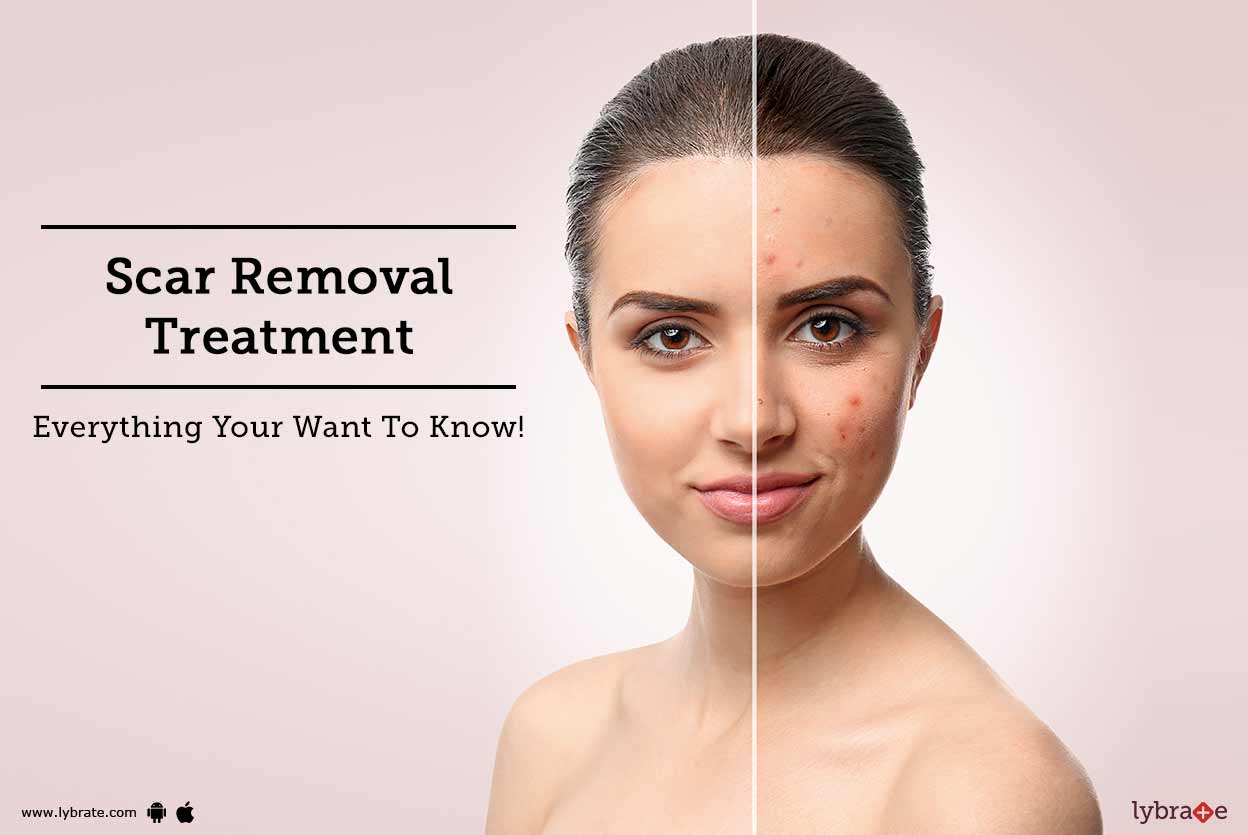 Scar Removal Treatment Everything Your Want To Know! By Dr. A.K