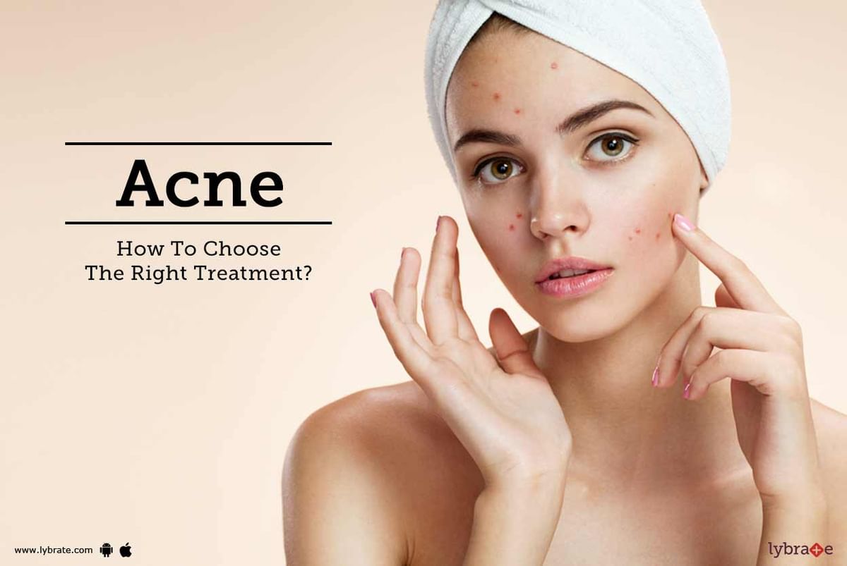 Acne - How To Choose The Right Treatment? - By Dr. Nimesh D Mehta | Lybrate