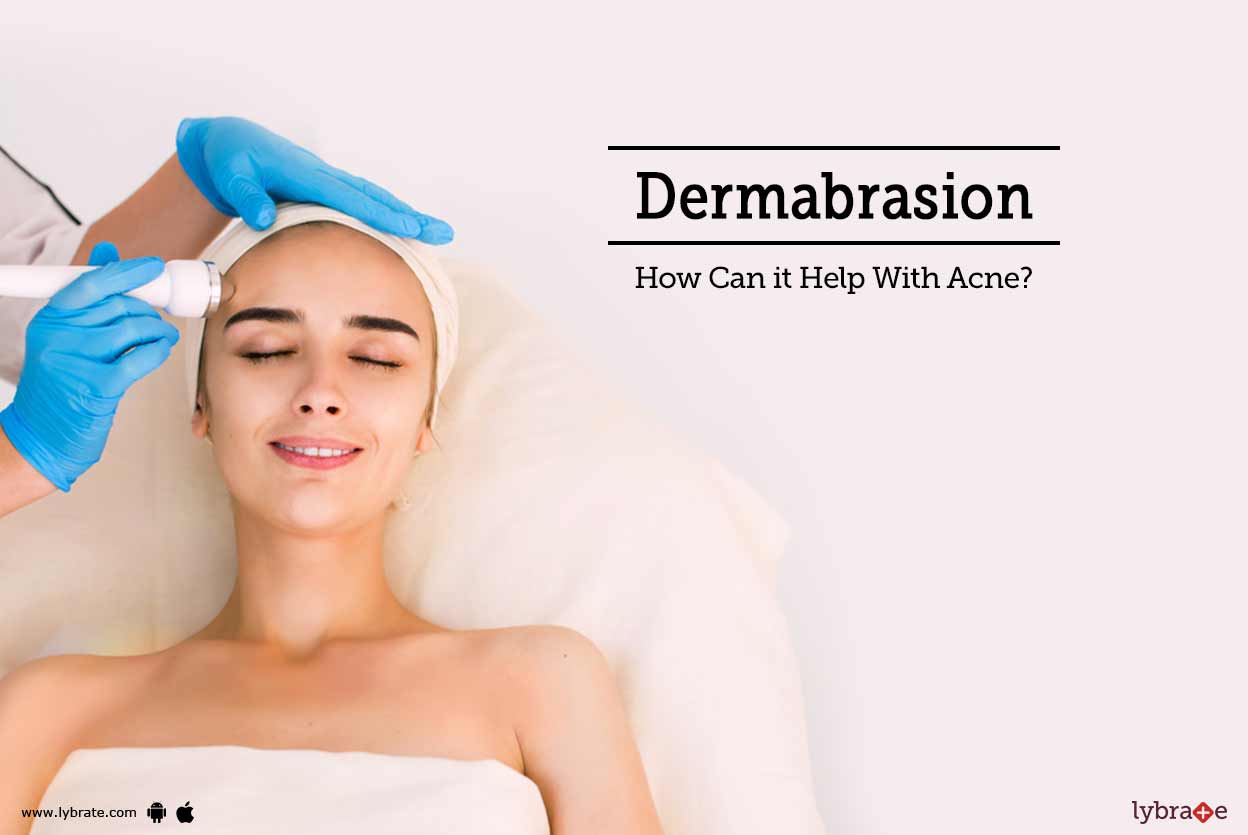 Dermabrasion How Can it Help With Acne? By Dr. Shobha Jindal Lybrate