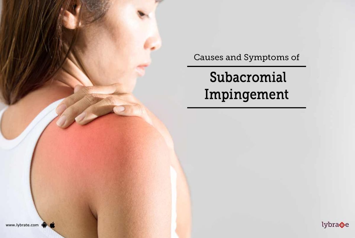 Causes And Symptoms Of Subacromial Impingement By Dr P Sharat Kumar My Xxx Hot Girl