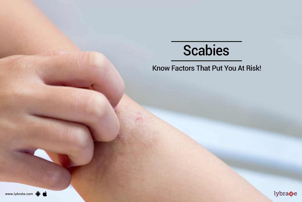 Scabies Know Factors That Put You At Risk! By Dr. Rahul Shetty Lybrate