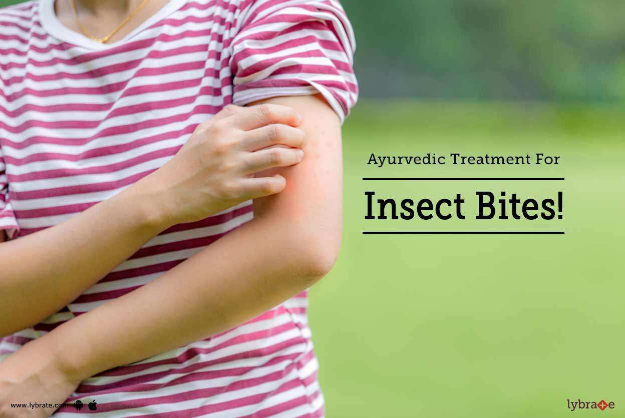 Ayurvedic Treatment For Insect Bites! By Dr. Jayaprakash Bahuleyan Lybrate