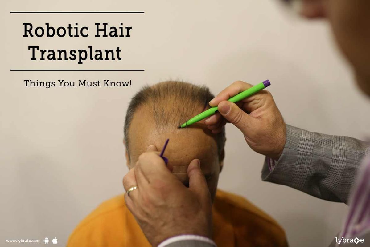 Robotic Hair Transplant - Things You Must Know! - By Hairline International  | Lybrate