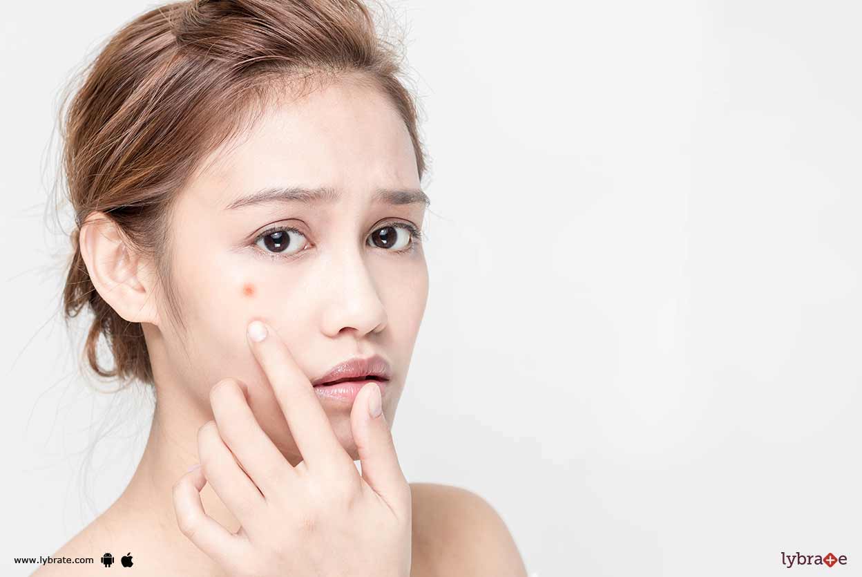 Acne Flare Up Know Regimen For It! By Dr. Bharti Verma Lybrate