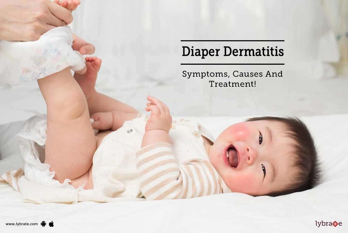 Diaper Dermatitis -Symptoms, Causes And Treatment! - By Dr. Manju ...