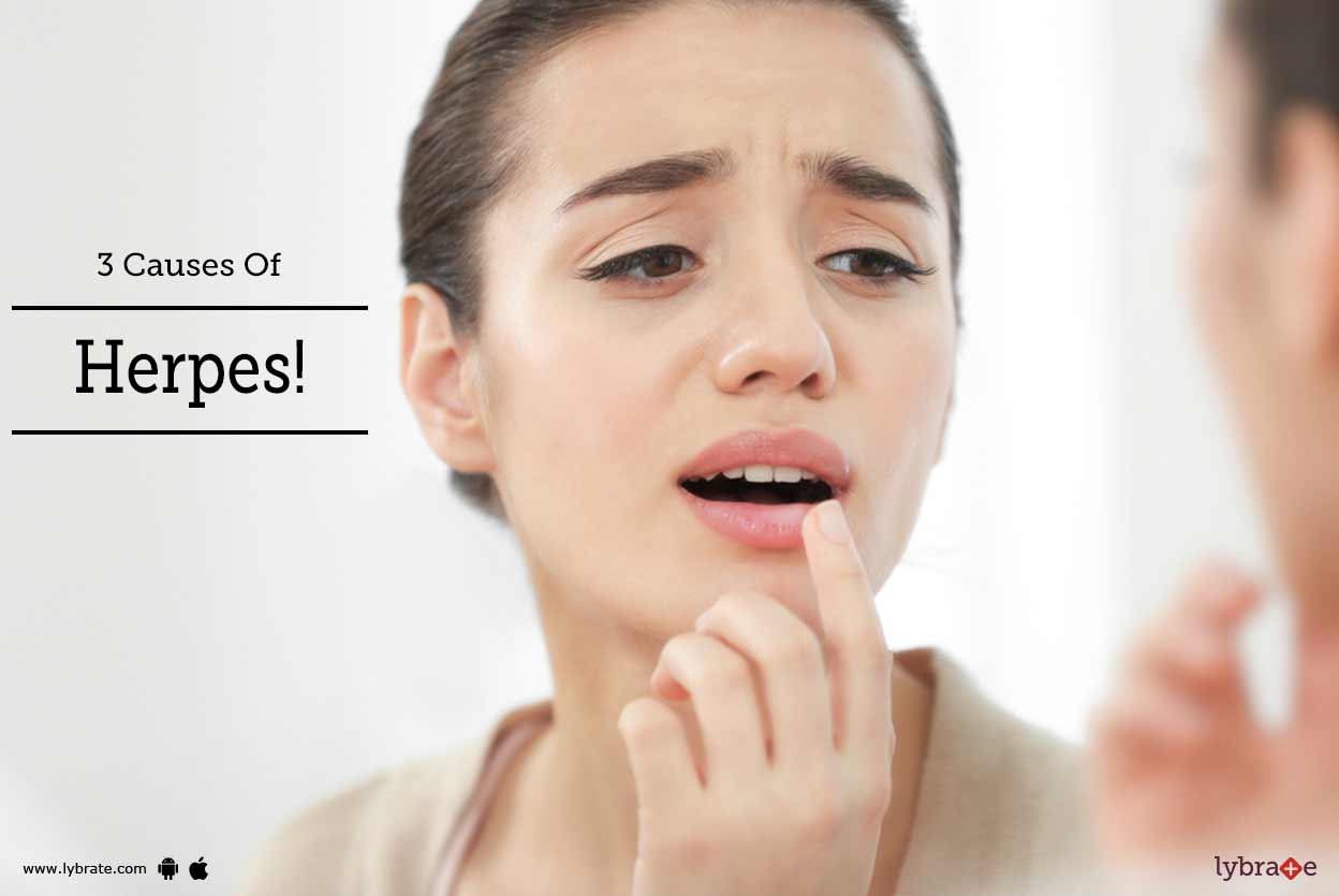 3 Causes Of Herpes!