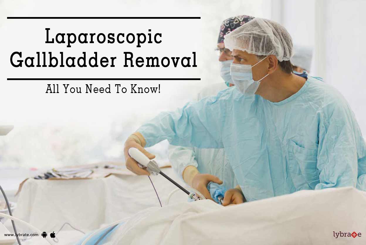 Laparoscopic Gallbladder Removal All You Need To Know! By Dr. Ashvind Bawa Lybrate
