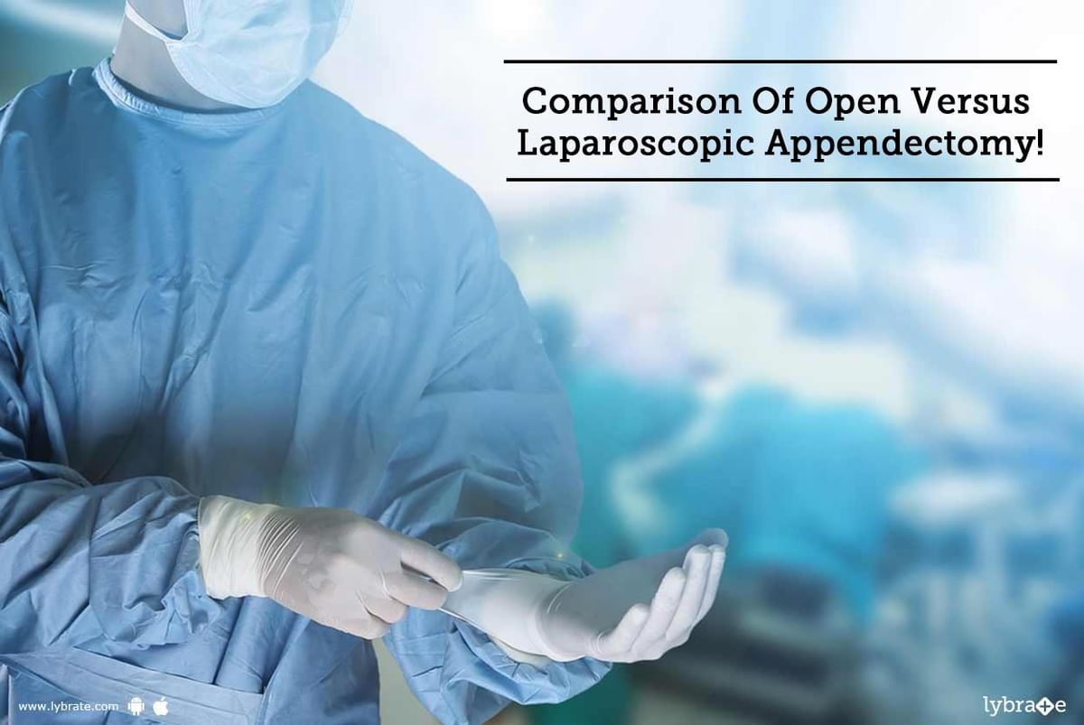 Comparison Of Open Versus Laparoscopic Appendectomy! - By Dr. Puneet ...