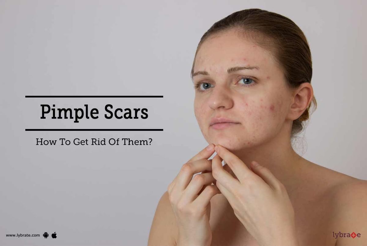 Pimple Scars How To Get Rid Of Them By Dr Rahul Shetty Lybrate 5320